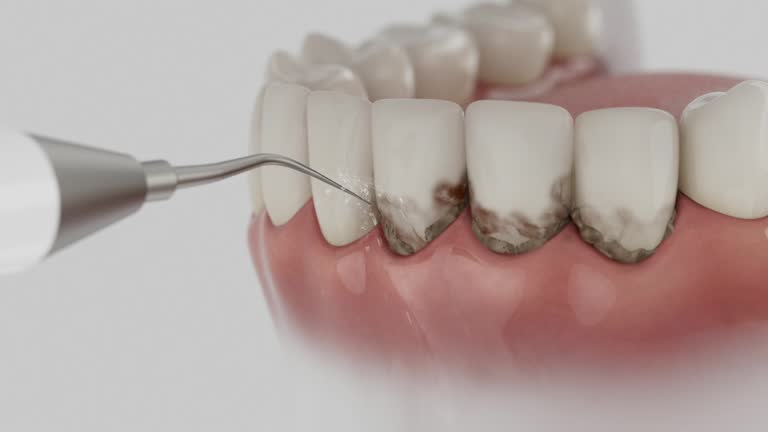 Reliable Dental Implants contractor in Lutz, FL by Smile Center Dentistry